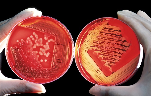 Crevne bakterije mogu da izazovu, predvide i spreče reumatoidni artritis