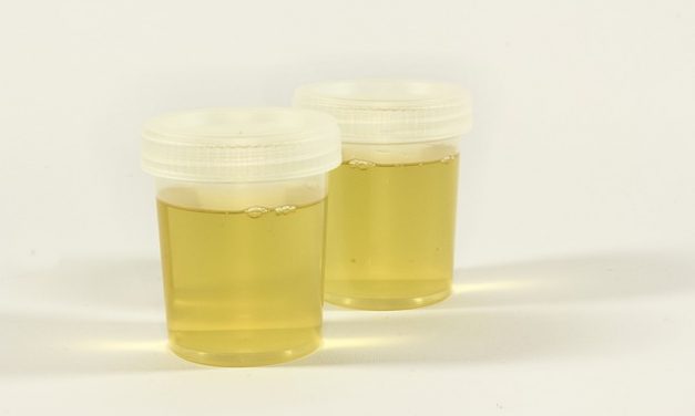 Koncetracija urina i piurija za utvrđivanje dijagnoze infekcije urinarnog trakta kod odojčadi