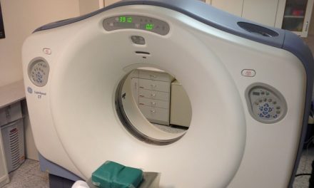 Korisnost spektralne kompjuterizovane tomografije pri proceni aktivnosti Kronove bolesti