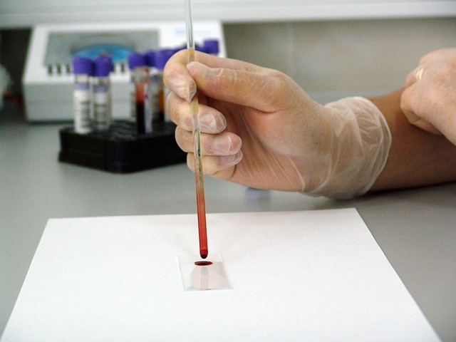 Jednostavan test krvi može pomoći u identifikovanju osoba koje su u riziku od srčanog udara